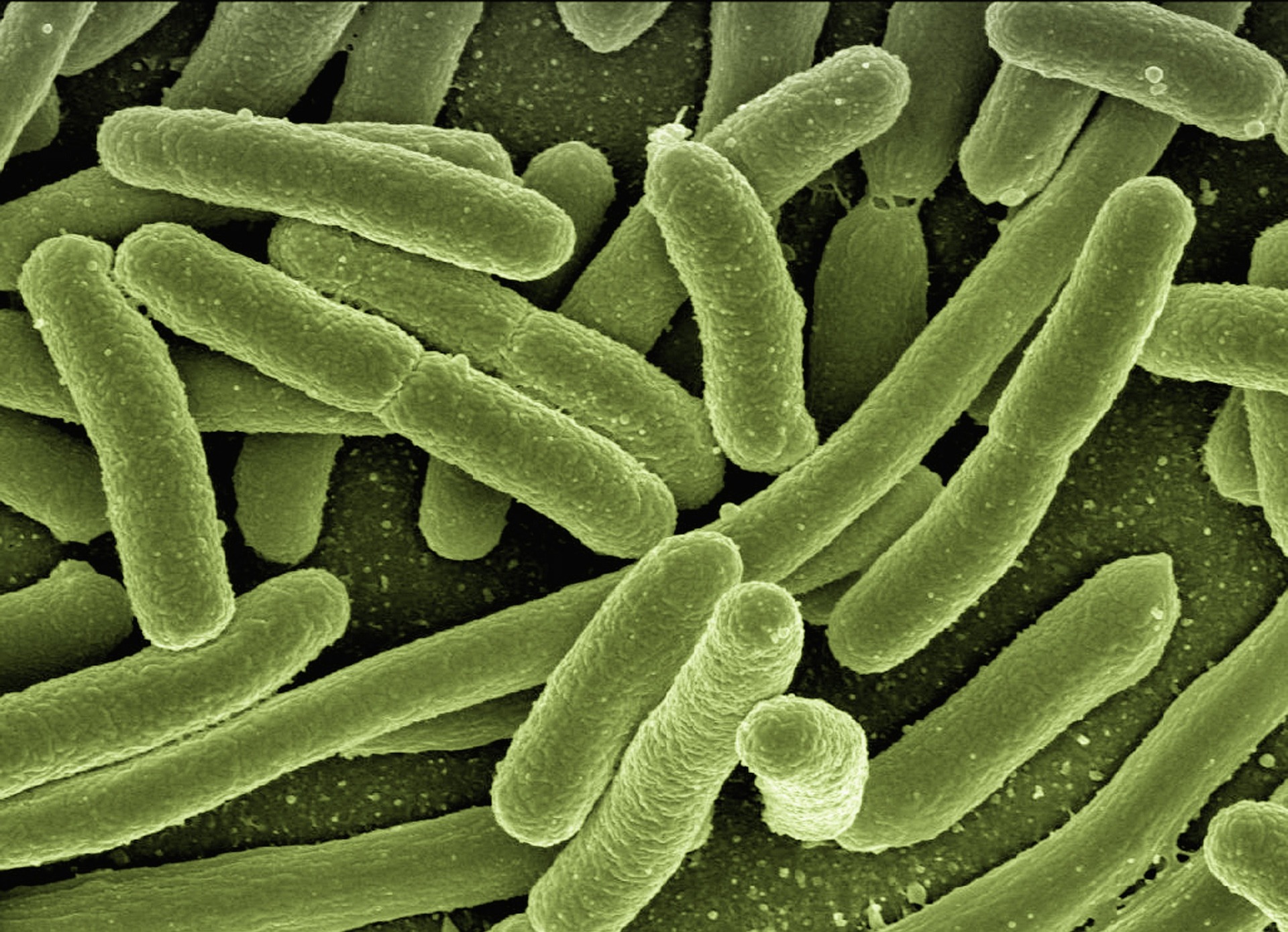 koli-bacteria-123081_1920